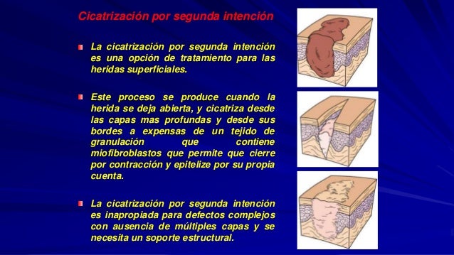 INCISION QUIRURGICA EN CARA Y CUELLO