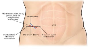 Incisions and position in general surgery by dr chandrakant sabale | PPTX