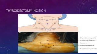 Lahey Incision Incisions and position in general surgery by dr chandrakant sabale | PPTX