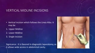 Incisions and position in general surgery by dr chandrakant sabale | PPTX