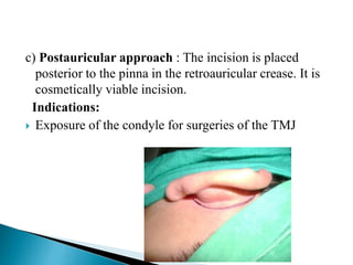 incisions-in-head-and-neck-region-pptx