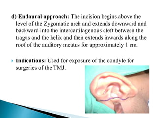 Incisions in head and neck region | PPTX