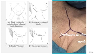 To My Incision Incisions in the neck, thyroidectomy, parathyroidectomy | PPTX