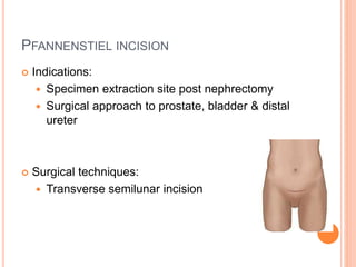Incisions in Urology.pptx