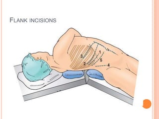 Incisions in Urology.pptx