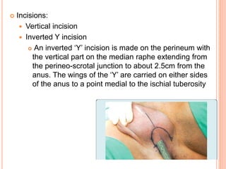Single Y Incision Incisions in Urology.pptx