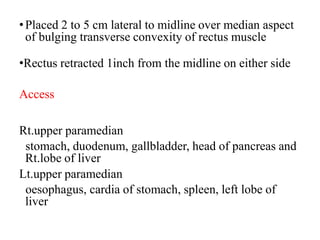 Abdominal incision | PPTX