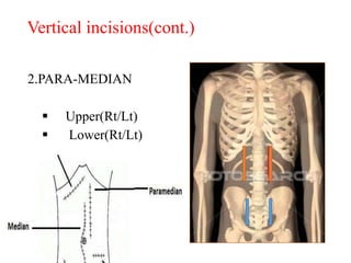2.PARA-MEDIAN
 Upper(Rt/Lt)
 Lower(Rt/Lt)
Vertical incisions(cont.)
 