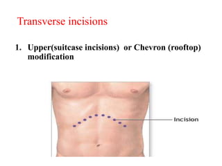 1. Upper(suitcase incisions) or Chevron (rooftop)
modification
Transverse incisions
 