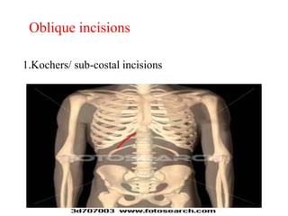 1.Kochers/ sub-costal incisions
Oblique incisions
 