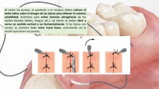 Al cortar los puntos, el ayudante o el cirujano deben colocar el
dedo índice sobre la bisagra de las tijeras para obtener la máxima
estabilidad. Asimismo para evitar lesiones iatrogénicas de los
tejidos blandos (labios, lengua, etc.), las tijeras se deben abrir y
cerrar en sentido vertical y no horizontalmente. Si las tijeras son
curvas, su extremo debe mirar hacia fuera, controlando así la
acción que hacen sus puntas.
 
