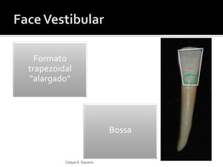 Bossa
Formato
trapezoidal
“alargado”
Caíque A. Siqueira
 