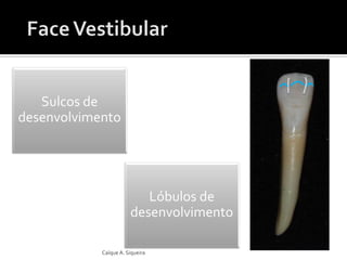 Lóbulos de
desenvolvimento
Sulcos de
desenvolvimento
Caíque A. Siqueira
 