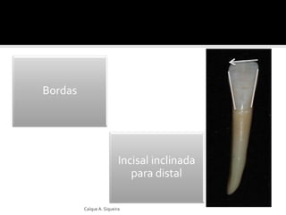 Incisal inclinada
para distal
Bordas
Caíque A. Siqueira
 