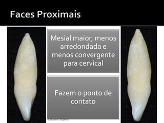 Mesial maior, menos
arredondada e
menos convergente
para cervical
Fazem o ponto de
contato
Caíque A. Siqueira
 