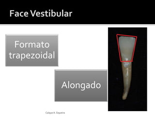 Formato
trapezoidal
Alongado
Caíque A. Siqueira
 