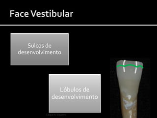 Lóbulos de
desenvolvimento
Sulcos de
desenvolvimento
Caíque A. Siqueira
 