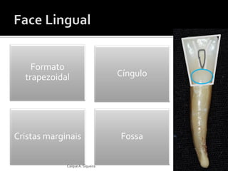 Cíngulo
Formato
trapezoidal
Cristas marginais Fossa
Caíque A. Siqueira
 