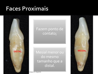 MESIALDISTAL
Fazem ponto de
contato;
Mesial menor ou
do mesmo
tamanho que a
distal.
Caíque A. Siqueira
 