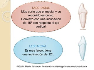 LADO DISTAL:
Más corto que el mesial y su
recorrido es curvo.
Convexo con una inclinación
de 15º con respecto al eje
vertical.
LADO MESIAL:
Es mas largo, tiene
una inclinación de 12º.
 