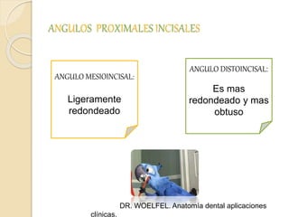 ANGULOS PROXIMALES INCISALES
ANGULO MESIOINCISAL:
Ligeramente
redondeado
ANGULO DISTOINCISAL:
Es mas
redondeado y mas
obtuso
DR. WOELFEL. Anatomía dental aplicaciones
clínicas.
 