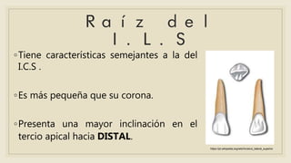 ◦Tiene características semejantes a la del
I.C.S .
◦Es más pequeña que su corona.
◦Presenta una mayor inclinación en el
tercio apical hacia DISTAL.
https://pt.wikipedia.org/wiki/Incisivo_lateral_superior
 