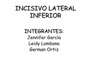 INCISIVO LATERAL INFERIOR INTEGRANTES: Jennifer García  Leidy Lombana German Ortiz 