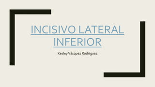 INCISIVO LATERAL
INFERIOR
KesleyVásquez Rodríguez
 