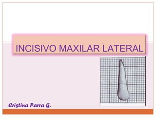 INCISIVO MAXILAR LATERAL
Cristina Parra G.
 
