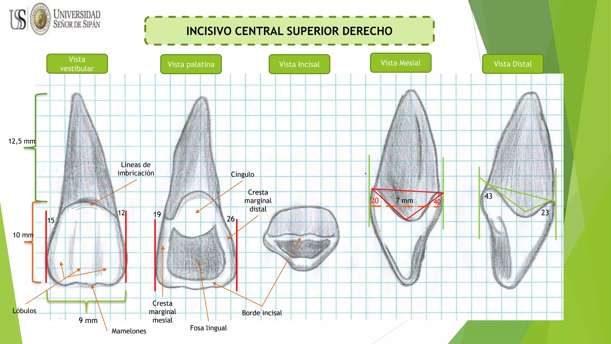 INCISIVOS CENTRLES Y LATERALES.pptx