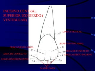 LINEA CERVICAL SURCO DISTO LABIAL AREA DE CONTACTO ANGULO DISTO INCISIVO MAMELONES ANGULO MESO INCISIVO AREA DE CONTACTO SURCO MESO LABIAL INCISIVO CENTRAL SUPERIOR IZQUIERDO ( VESTIBULAR) 