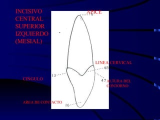 INCISIVO CENTRAL SUPERIOR IZQUIERDO (MESIAL) APICE LINEA CERVICAL ALTURA DEL CONTORNO CINGULO AREA DE CONTACTO 