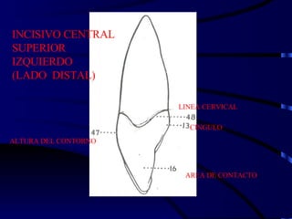 INCISIVO CENTRAL SUPERIOR IZQUIERDO (LADO  DISTAL) LINEA CERVICAL CINGULO AREA DE CONTACTO ALTURA DEL CONTORNO 