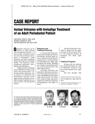 ©2006 JCO, Inc. May not be distributed without permission. www.jco-online.com




CASE REPORT
Incisor Intrusion with Invisalign Treatment
of an Adult Periodontal Patient
GAETANO TURATTI, DDS, DOS
RANDOL WOMACK, DDS
PIETRO BRACCO, MD, DDS, DOS




O   rthodontic intrusion can be
    effective in adult patients
with periodontal disease,1,2 as
                                                        Diagnosis and
                                                        Treatment Planning
                                                                                                   The final ClinCheck** pro-
                                                                                              vided 15 aligners for the upper
                                                                                              arch and 10 for the lower (Fig.
                                                              A 43-year-old female pre-
long as light, continuous forces                                                              2). The predicted duration of
                                                        sented with extruded, protrusive,
are used and excellent oral hy-                                                               treatment was about eight
                                                        and labially inclined upper in-
giene is maintained.3,4 Such                                                                  months.
                                                        cisors and generalized anterior
treatment can reduce infrabony                          spacing (Fig. 1). A fixed prosthe-
defects and improve periodontal                         sis had replaced the upper right      Treatment Progress
health,5-7 but requires a multi-                        bicuspids and molars. Bleeding
disciplinary approach8,9 and a                                                                     Scaling and root planing
                                                        was evident on periodontal prob-
highly motivated patient.                                                                     were performed before the start
                                                        ing, and the patient had a flat
      Stable posterior anchorage                                                              of orthodontic treatment, with
                                                        upper labial frenum.
can be difficult to achieve in pa-                                                            the scaling repeated every eight
                                                              Invisalign treatment was
tients with missing teeth.10 Al-                                                              weeks.
                                                        planned for derotation and intru-
though skeletal anchorage may                                                                      The first through 10th
                                                        sion of the upper incisors and ca-
be useful, the following case                           nines and uprighting of the upper
demonstrates intrusion of the                           right central incisor. The lower
upper incisors using only remov-                                                              *Registered trademark of Align Technology,
                                                        arch required slight intercanine      Inc., 851 Martin Ave., Santa Clara, CA
able Invisalign* appliances in an                       expansion to allow the alignment      95050.
adult patient with periodontal                          and uprighting of the upper in-       **Trademark of Align Technology, Inc., 851
disease.                                                cisors.                               Martin Ave., Santa Clara, CA 95050.




Dr. Turatti is in the private practice of orthodontics at via F. Pao-
lini 12, 10138 Turin, Italy. Dr. Womack is an Associate Profes-
sor, Orthodontic Department, Arthur A. Dugoni School of Dent-
istry, University of the Pacific, San Francisco; he has presented
educational workshops for Align Technology as an independent
contractor. Dr. Bracco is Chairman, Department of Orthodontics,
University of Turin, Italy. E-mail Dr. Turatti at gaetanoturatti
@aliceposta.it.
                                                                              Dr. Turatti    Dr. Womack               Dr. Bracco




VOLUME XL NUMBER 3                                                      © 2006 JCO, Inc.                                           171
 