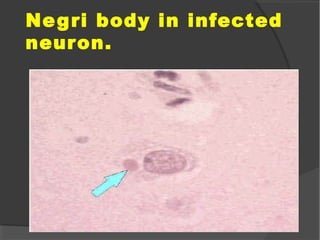 Negri body in infected
neuron.
 