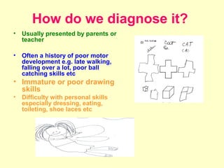 How do we diagnose it?
•   Usually presented by parents or
    teacher

•   Often a history of poor motor
    development e.g. late walking,
    falling over a lot, poor ball
    catching skills etc
• Immature or poor drawing
  skills
•   Difficulty with personal skills
    especially dressing, eating,
    toileting, shoe laces etc
 