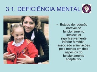 3.1. DEFICIÊNCIA MENTAL
• Estado de redução
notável do
funcionamento
intelectual
significativamente
inferior à média,
associado a limitações
pelo menos em dois
aspectos do
funcionamento
adaptativo.
 