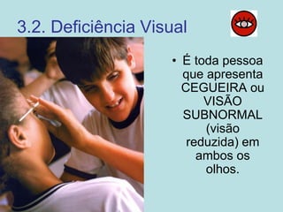 3.2. Deficiência Visual
• É toda pessoa
que apresenta
CEGUEIRA ou
VISÃO
SUBNORMAL
(visão
reduzida) em
ambos os
olhos.
 