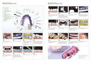 09
20191817
14 15 1613
1210 11
* При фиксации второй каппы возможны два варианта:
1. Извлечь первую трансферную каппу, оставив систему
сухого поля в полости рта.
2. Установить вторую трансферную каппу,
не извлекая первую.
Брекет-система Incognito™
Фиксация на Transbond™ IDB
Тщательно высушите воздухом без примеси
воды и масла. Проверьте поверхность зуба
с помощью зеркала.
Извлеките из флаконов А и B по 4 капли
в емкость для замешивания.
Храните адгезив Transbond™ IDB в холодильнике
до процесса смешивания (время работы
с охлажденным адгезивом увеличивается).
Активно перемешивайте аппликатором
в течение 10 секунд.
При непрямой фиксации нанесите тонкий слой
адгезива на каждое индивидуализированное
основание брекета в каппе (ассистент).
Нанесите тонкий слой того же адгезива
на поверхность зуба (ортодонт).
Проверьте с помощью зеркала.
Установите и прижмите каппу на 3 минуты,
оставьте еще на 1 минуту.
Сначала извлеките систему сухого поля,
затем трансферную каппу. Извлекать каппу
нужно от моляров к резцам, от щечной
стороны зубов к лингвальной.
Используйте скриншоты для оценки точности
позиционирования брекетов.
С помощью скалера и флосса удалите излишки
материала с брекетов и контактных
поверхностей зубов.
С помощью флосса убедитесь, что все контактные
поверхности свободны от материала.
При необходимости используйте штрипсы
для апроксимального пришлифовывания.
Проверьте наличие преждевременных контактов
на молярах и премолярах с помощью
артикуляционной бумаги. Контакты на передних
зубах можно оставить.
Сошлифуйте преждевременные контакты
на боковых зубах.
10 секунд
Химическое
отверждение
05 06 07 08
01 02 04
13
14
16
17
2
10
12
4
5
6
7
9
8
1
11
3
15
03
Расположите каппу во рту для проверки
точности ее прилегания.
Брекет-система Incognito™
Фиксация на Transbond™ IDB
Поместите прокладки для впитывания
слюны за каждую щеку и используйте
систему сухого поля.
Очистите поверхность брекетов ацетоном.
Нанесите гель для травления эмали
на лингвальную поверхность зубов
(35% фосфорная кислота) на 30 секунд.
Используйте скриншоты для визуального
контроля.
Чтобы увидеть все поверхности, которые должны
быть обработаны пескоструйным аппаратом,
воспользуйтесь скриншотами.
Используйте оксид алюминия (до 50 мкм, 3–5 бар,
3-4 сек. на зуб).
Удалите протравливающий гель отсосом.
Обработайте пескоструйным аппаратом.
Убедитесь, что он расположен под правильным
углом, чтобы не повредить слизистую десны.
Накройте лицо пациента защитной салфеткой.
Промойте водой.
Вам понадобятся:
Ё 1. Трансферная каппа
Ё 2. Система сухого поля
Ё 3. Прокладки для впитывания слюны
Ё 4. Гель для травления эмали
Ё 5. Зеркало
Ё 6. Пинцет
Ё 7. Скалер
Ё 8. Пескоструйный аппарат
Ё 9. Скриншоты (экранные снимки)
Ё 10. 100% ацетон
Ё 11. Штрипсы для апроксимального пришлифовывания
Ё 12. Ватные ролики и флосс
Ё 13. Адгезив Transbond™ IDB Pre-Mix
и одноразовые поддоны для замешивания
Ё 14. Шаровидный бор
Ё 15. Артикуляционная бумага
Ё 16. Аппликатор
Ё 17. Кисточка
30 секунд
 
