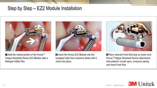 12
3M Marketing
All Rights Reserved.© 3M 2014
Step by Step – EZ2 Module Installation
 