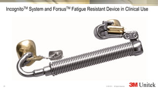 20
3M Marketing
All Rights Reserved.© 3M 2014
IncognitoTM System and ForsusTM Fatigue Resistant Device in Clinical Use
 
