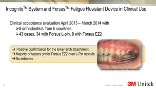 24
3M Marketing
All Rights Reserved.© 3M 2014
Clinical acceptance evaluation April 2013 – March 2014 with
8 orthodontists from 6 countries
43 cases, 34 with Forsus L-pin, 9 with Forsus EZ2
 Positive confirmation for the lower arch attachment
Majority of testers prefer Forsus EZ2 over L-Pin module
No debonds
IncognitoTM System and ForsusTM Fatigue Resistant Device in Clinical Use
Clinical photography courtesy Dr Nina Heinig, Germany
 