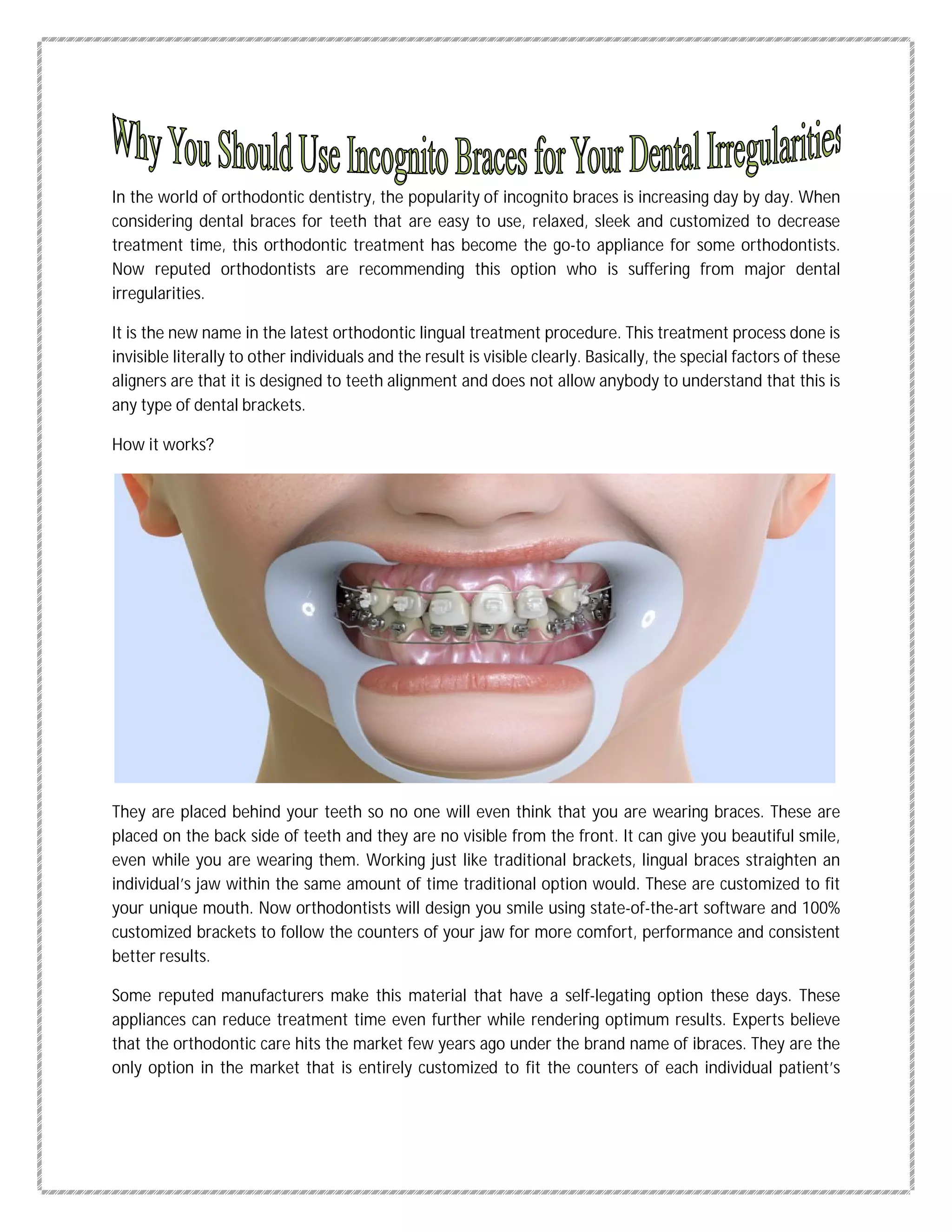 Incognito Braces | PDF