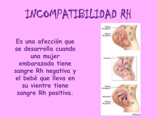 INCOMPATIBILIDAD RH
 Es una afección que
se desarrolla cuando
      una mujer
  embarazada tiene
sangre Rh negativa y
el bebé que lleva en
   su vientre tiene
 sangre Rh positiva.
 