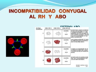 SISTEMA ABOSISTEMA ABO
 