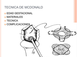 INCOMPETENCIA ITSMICO CERVICAL