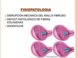 INCOMPETENCIA ITSMICO CERVICAL