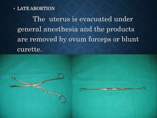 • LATE ABORTION
The uterus is evacuated under
general anesthesia and the products
are removed by ovum forceps or blunt
curette.
 