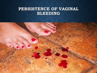 PERSISTENCE OF VAGINAL
BLEEDING
 