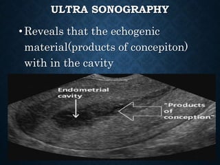 ULTRA SONOGRAPHY
•Reveals that the echogenic
material(products of concepiton)
with in the cavity
 